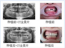 隐形女性不孕